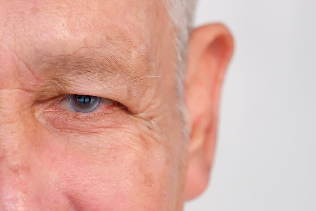 symptoms of glaucoma